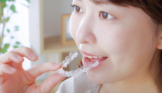 歯の矯正期間はどれくらい？平均期間や短縮するコツを解説！