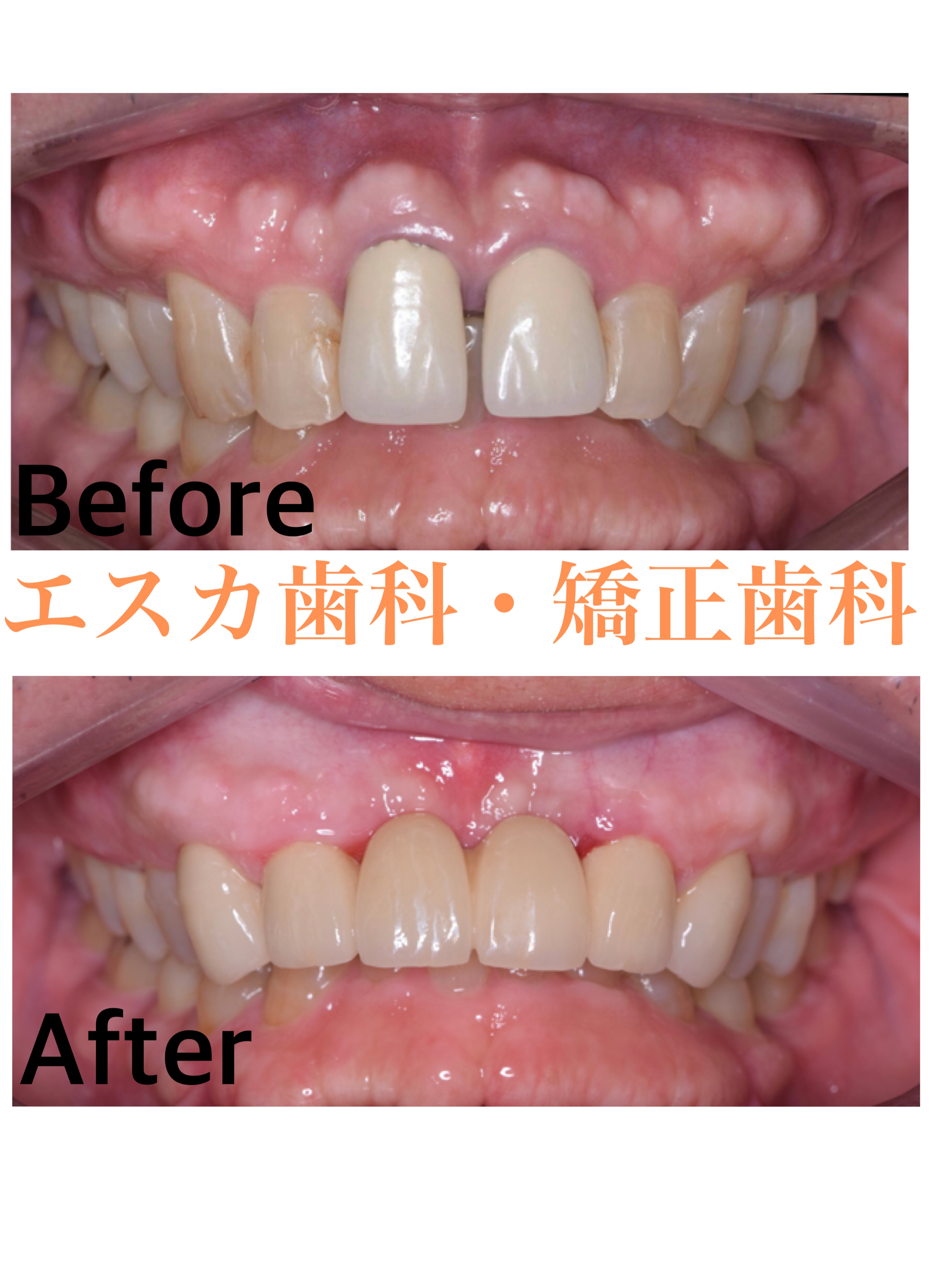 エスカ 名古屋 インプラント 歯科 予約 エスカ歯科・矯正歯科（愛知県名古屋市中村区）の求人情報