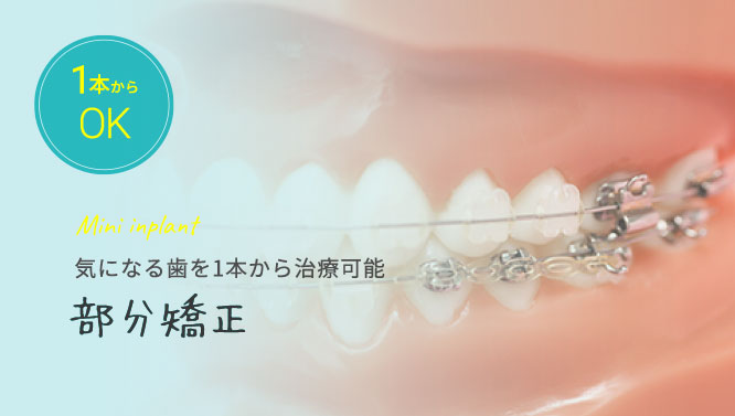 Mini inplant 気になる歯を1本から治療可能 部分矯正