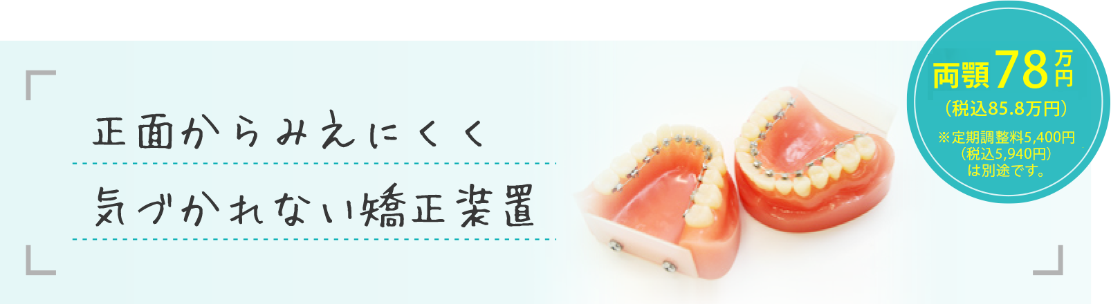 正面からみえにくく気づかれない矯正装置